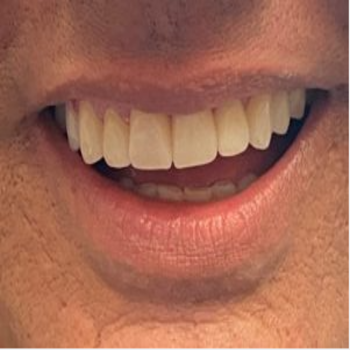 Dental-Teeth