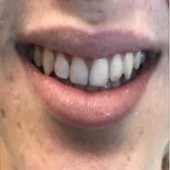 Dental