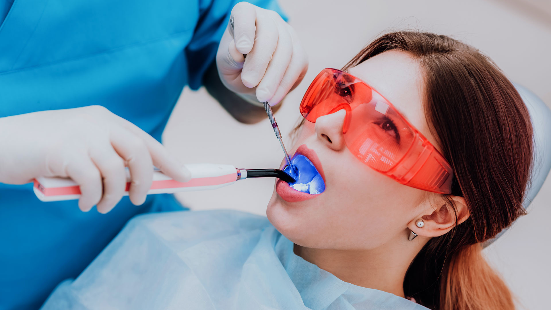 Dental Sealant Services Miami Florida