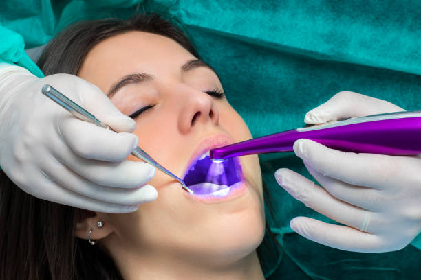 Dental Sealant Services