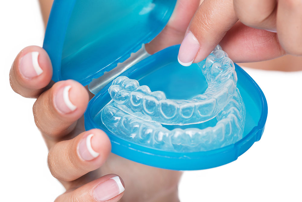 Invisalign-Services-in-Miami