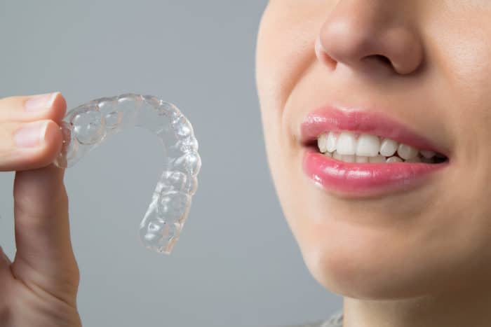invisalign in miami