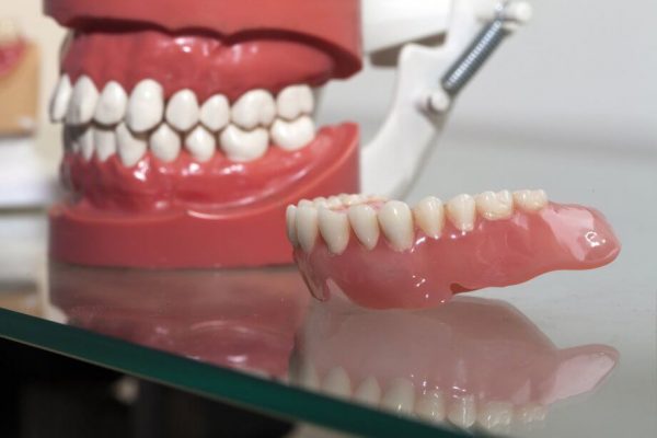 Full Mouth Reconstruction